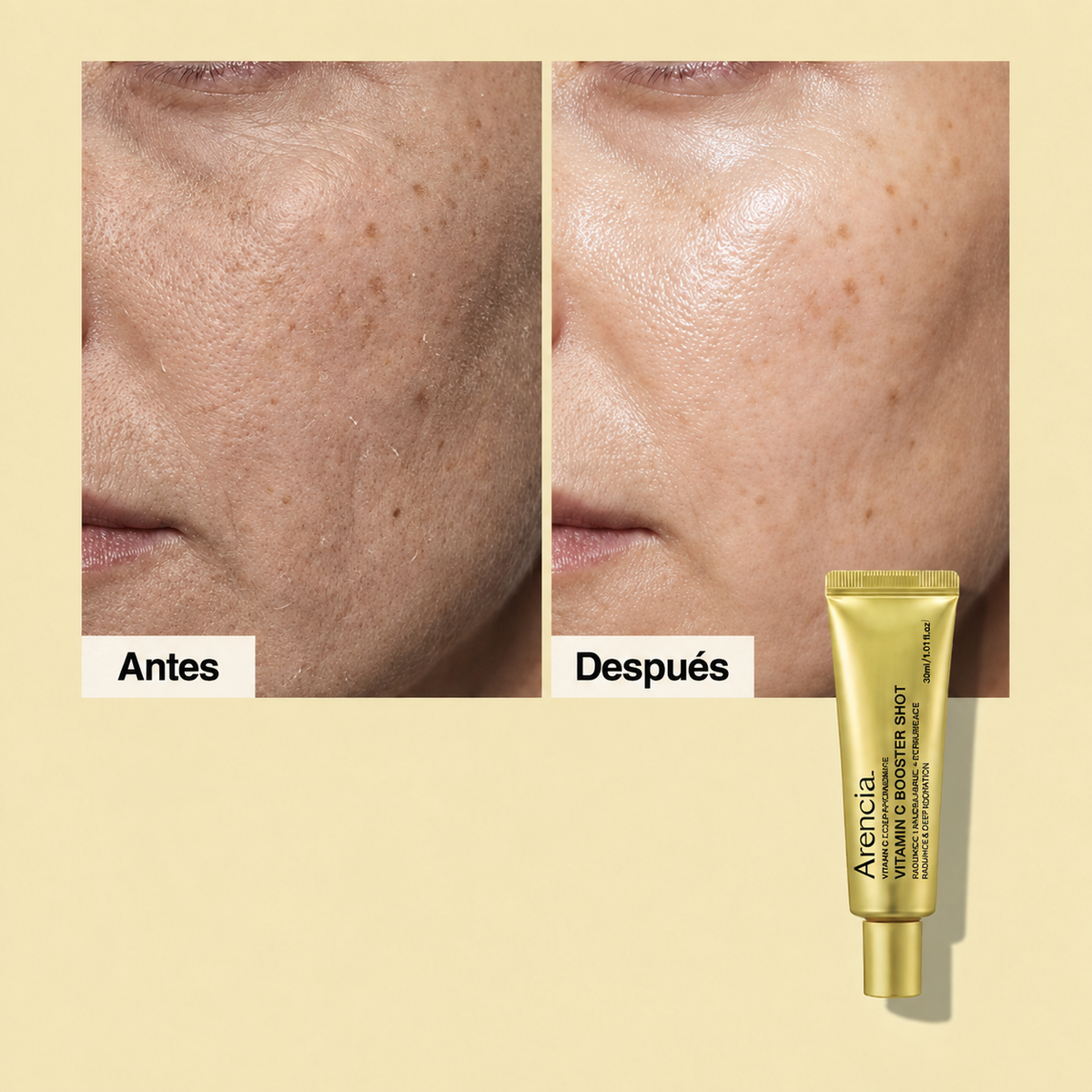 Arencia Vitamin C: antes y después