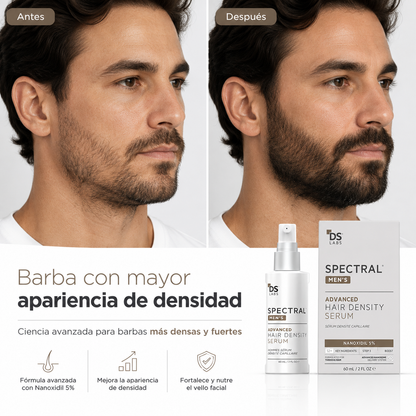 Spectral Men’s 5% – Densidad Capilar Avanzada