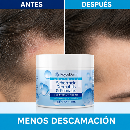 RoyceDerm – Crema para Dermatitis y Psoriasis 100 ml
