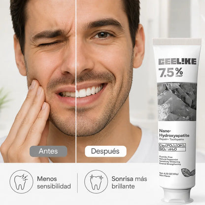 CEELIKE 7.5% nHAP – Reparación del Esmalte