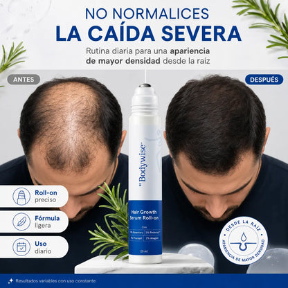 Bodywise Hair Growth Roll-On 25ml