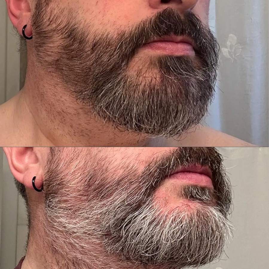 Comparación del aspecto de las canas en la barba de un cliente