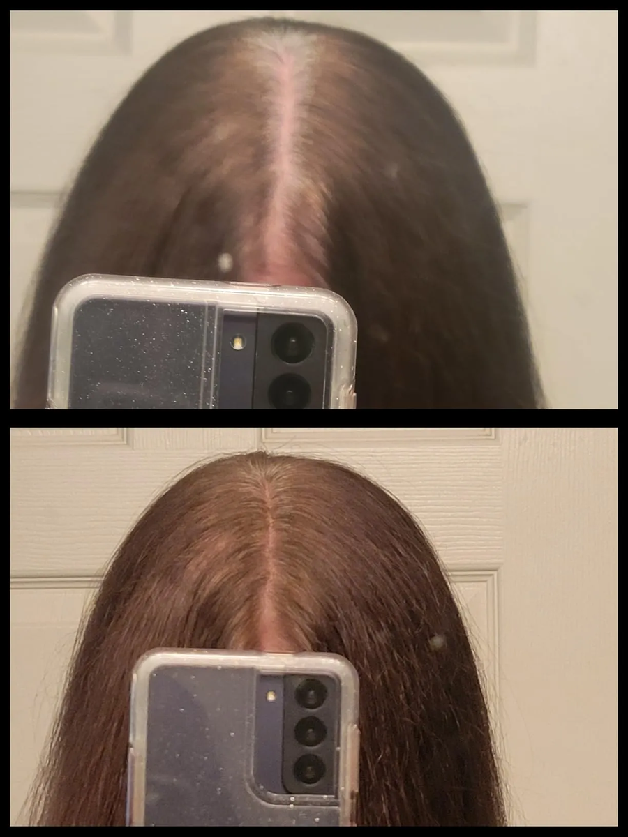 Fotos de una clienta comparando el aspecto de la raya del cabello